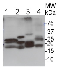 Lhc1 | from PSI of red alga in the group Antibodies for Plant/Algal / Photosynthesis / LHC at Agrisera AB (Antibodies for research) (AS08 282)